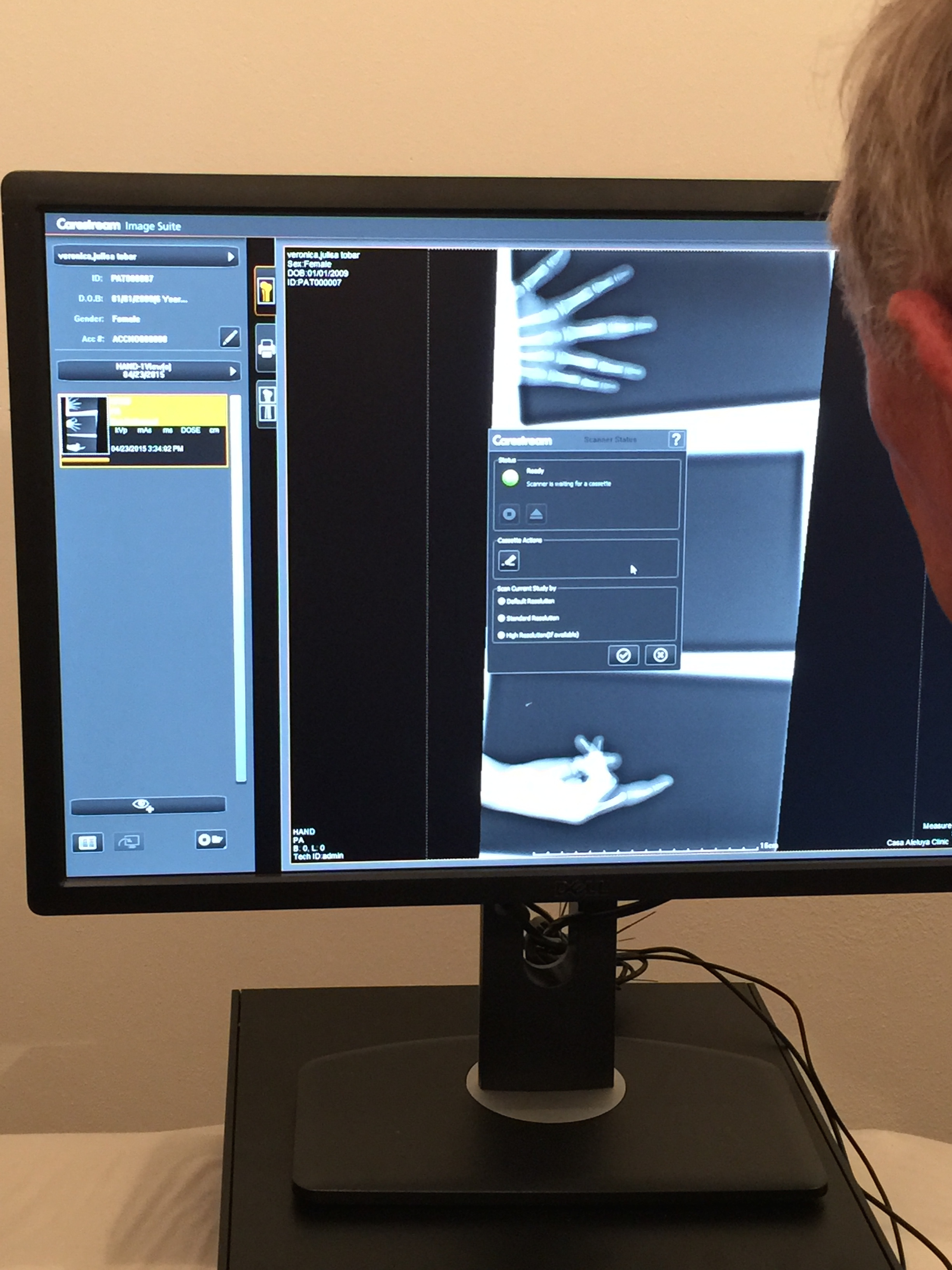 The x-ray equipment will make all the difference